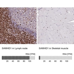 SAMHD1 Antibody, Novus Biologicals 25 &mu;L; Unlabeled:Antibodies, Polyclonal